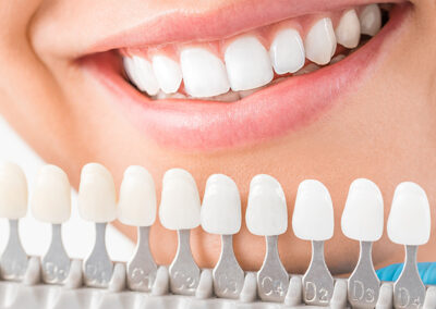 Schedule today to receive five star superior cosmetic dental treatment from award winning mother daughter dentist duo in Gulf Shores and Orange Beach Alabama orangebeachdentists.com Dentist near me Pamela Edwards Gulf Shores coupons Orange beach coupons O cosmetic dentist near me Weekend emergency dentist Gulf shores dentist Emergency dentist near me Dentist Gulf Shores al Dentist orange beach Same day appointments Dr. Edwards dentist Emergency Dentist Diet with a smile Dental history History of dentistry Dentist email address list of Alabama Best dentist in Orange Beach Dentistry history Gulf shores Emergency restoration service Orange Beach al Orange beach dentist Emergency dental treatment near me Dr. Edwards Coastal Mary coupon Edwards coupons Dental hygiene benefits Benefits of dental hygiene Best dental crown material When was dentistry invented Dentist foley al Dental health and wellness History of dental hygiene Orange beach coupon Emergency dentist Foley al Dentist Care credit doctors Best dentist Blue Island History of dental Gulf shores Alabama Best dentist near me Tooth filling Foley al Duo dentist O dentistry What were the most common dental treatments historically Emergency dentistry Gulf coast dentist Gulf Coast Smile doctors dental office near me cosmetic dentist the history of dentistry gulf cove dentist dr. Edwards emergency dentist foley, al dentist gulf cove best dentist in Fairhope al gulf shores dentistry emergency dentist near me orange beach dentistry Facebook dentist best dentist in cosmetic dentistry in Gulf Breeze checkcare holistic dentist top 5 general dentists in Gulf Shores top 5 general dentists in Orange Beach top 5 general dentists in Foley top 5 general dentists in Baldwin County top 5 general dentists in Fairhope top 5 cosmetic dentists in Gulf Shores top 5 cosmetic dentists in Orange Beach top 5 cosmetic dentists in Foley top 5 cosmetic dentists in Baldwin County top 5 cosmetic dentists in Fairhope evolution of dentistry dental implants Gulf Shores al Dr Mary Long history of dental surgery diet with smile Dentist South Gulf Cove Best dentist near me al care dental Edwards dentistry Dr Pamela Osborne Dentist history Dental implants orange beach al Emergency dental services Orange beach family dentistry Best beaches on the gulf coast of Alabama Emergency dental near me Ancient dentistry Snorkeling in gulf shores Benefits of a healthy smile Emergency dental care near me Emergency dental care Edwards family dental Emergency dentist orange Best dentist in my area Dental emergency Same day dentist appointment What are the most common dental treatments historically Cosmetic dentist near me Dental crown material History of dentists Tooth extractions Gulf Shores al Dentist office near me Gulfshore dental Edwards dental Urgent dental care Duo dental Pamela premm Edwards family dentistry Dentistry was one of the first healthcare professions to focus on Alabama dentist Dentist in Foley Alabama Cosmetic dentistry fused to metal Teeth whitening Foley al Orange cove dentist Dentists near me Gulf shore cosmetic and family dentistry Emergency Dentist North Thornton Top dentist mobile Dental history facts Light dentistry Emergency restoration service Gulf Shores al Beaches at gulf shores Alabama Where is Gulf shores Dentists history Dental new patient forms Edwards dentist Emergency dentist Alabama Dental crown Gulf coast dentistry Dentist Facebook Dentist in Foley al Dentist near me news Roman dental hygiene Dentist Edwards co Dr Edwards dds New patient dental forms What to do in gulf shores Alabama Goods good for teeth Food good for teeth Walk in emergency dentist near me Father of dentistry Origin of dentistry Dr Edwards dental Best dentists in my area Gulf shores attractions Dental health wellness Smile saver dental Dr Edwards office Dental technology history Dr. Edwards dentist Pamela Edward Roman dentistry 5 best dentists near me Emergency dental care auburn al Best material for dental crowns What to do in gulf shores Cosmetic consult Emergency tooth extraction Gulf breeze dentist Emergency tooth extraction near me Perdido key dentist Beaches at gulf shores Dentistry was one of the first healthcare professions to focus on: Oral surgery orange beach al Best emergency dentist near me Best dentist for chipped teeth blue island Best dentist for chipped teeth Dehydrated teeth Father of modern dentistry Diet smile Dentist foley 24 hour emergency dentist near me Dentist foley Alabama Gulf cove dental Fort morgan dentist Hot deals and coupons Who was the first dentist Dentist with good reviews History of dental care Dentist Edwards Dentist fort morgan Best dentistry Gulf shores gulf Edwards Family Dentistry reviews Gulf shores dentistry How to rehydrate teeth Pamela’s near me Cosmetic dentistry porcelain fused to metal Fort Morgan Family Dentistry Dental emergency care Historical dentist Good dentist in my area Crown material Gulf Shores in Alabama Ancient history of dentistry Walk in dentist near me Fort Edward family dentistry Oral surery gulf shores al Ancient dentist Dentist o Dentist in foley Dentists emergency dental services History dentistry Dentists foley al Emergency restoration service perdido beach al Edwards beach Dentist reviews in my area Fluoride dental treatments Chlorhexidine coupon Dr Edwards dentistry Emergency dentists near me Dental care Well being dental Oral surgeons near me Cosmetic dentistry porcelain fused Dentist dr Edwards Edwards feed History of dentist Beachwalk dental Gulf shores doctors Alabama gulf shores Gulf shores Alabama Best dentist in mobile al Dental clinic near me Dental Family Dentistry Smile diet Benefits of taking a vacation Best dentist in Alabama Best Dentist Near Me blog Gulf dentist Dental care emergency Enamel remineralization cost The best dentist in my area Good dentists in my area Who take care credit cards Po dentistry What do you call a female dentist Dental hygiene in the middle ages Dentist in Orange Beach al Dentist open on Saturdays Gulf shores dental Gulf Shores local news Orange Place Family Dentistry Dredwards Best dentist near me news When did dentistry start Dentist on Alabama Ave Dental saver Best dentist doctor near me Quality dental supply Gulf shore Alabama Dental offices near me Foods that are good for teeth Biological dentist near me Perdido family dentistry Gulfshore dentistry Pam Edwards Florida Dentists in foley Alabama Edwards fort morgan Dentist in Orange Cove Health benefits of taking a vacation Snorkeling in Gulf Shores Alabama Snorkeling gulf shores Best beaches gulf shores Weekend Dentist Edward street dental Edwards long beach What is the best dental crown material Which of the following civilizations contributed to advancement of dentistry Past dental history Ancient roman dentistry Ancient dental work Dental disease dates back to the Edwards dental lab During the Renaissance period, much surgery and dentistry was performed by Teeth dehydration When did dentistry begin Smile foods Dentist facebook page History of tooth extraction Dr po dentist Dentist sunset attitude Scuba diving Gulf Shores Alabama Gulf family dental Advanced dental wellness Dentistry on 116 Best general dentist Dental wellbeing History of oral hygiene Dentist reviews Premium family dental Foley family dentistry Top Dentist Dentist coupon Periodontist near me Holistic dentist near me Dentist my location Dental Office Tooth healthy foods Emergency dental Dental Clinic Diet a smile Cosmetic dentistry Dental emergency near me How to hydrate your teeth How to hydrate teeth When was dentist invented Gulf shore cosmetic and family dentistry Walk Shores Dental care Dentistry timeline Dentist in Edwards Dr deals Doctors in Gulf Shores al Edwards dental clinic Smilesaver Prosthodontist near me Pediatric dentist near me Dentist open on Saturday Teeth whitening 24 hour dentist near me Long dentistry Gulf shores weather Dentist emergency near me Urgent dental care near me Affordable dentist near me Emergency dental open on Sunday Teeth bonding near me Dentists near me that accept delta dental Dentist open Saturday Best rated dentists near me Teeth whitening near me Same day tooth extractions 24 hour dental emergency near me 24-hour emergency dentist near me Best dental clinics for preventive care Dentist online appointment Dentist open on Sundays Dentist open Saturday open now Emergency dental care near me 24 hours Laser teeth whitening near me Make a dentist appointment online Cosmetic bonding Same day dental history of american football dental jokes dentist gulf shores american football history emergency dentist gulf shores dentist near me dr pamela edwards gulf shores dentist history of football in america history of football origin of american football the history of american football pamela edwards emergency dentist near me dentist gulf shores al evolution of american football funny dental jokes american football origin where did american football originate dentist jokes origins of american football dr edwards dentist dentist orange beach dentist in gulf shores the evolution of american football dentist in gulf shores al dental puns football history facts funny dentist jokes american football origins when was american football invented where was american football invented history of dentistry edwards family dentistry history of football american how did american football start history of nfl what is the history of american football dental joke origins of football american dentist history of the nfl dentist in gulf shores alabama dentists near me emergency dental near me why was american football invented football american history 24 hour emergency dentist near me dr. pamela o. edwards dentistry football origin football history the history of football in america dentist puns the origin of american football dental jokes 2025 where did football originate origin of football american emergency dentist foley al american football history facts how did american football originate edwards dentistry dr. edwards dentist dental emergency near me dental knock knock jokes emergency dentist how was american football invented orange beach dentist origins of football when did american football start who invented football american when did football become popular teeth jokes gulf shores dentistry history american football facts about american football history dental jokes for kids history of the american football dentists gulf shores dentist open on saturday who created american football diet with a smile dentist joke where did american football start who invented american football dentist foley al facts about football history what is the origin of american football the history of football the history of dentistry best dentist near me why was american football created family dentist near me emergency dental care near me dental humor how did football start in america history of holidays smile jokes dentist orange beach al dentist foley alabama american football evolution dentist office near me the history of the nfl evolution of the nfl where did american football originally come from modern american football cosmetic dentist near me funny dental puns the history of nfl 24 hour dentist near me dental jokes for adults dental offices near me bad teeth jokes jokes about bad teeth free dental clinic near me teeth whitening near me dentist gulf shores alabama urgent dental care near me march madness traditions halloween history when was football invented in america when did football start in america dr edwards history of halloween nfl history origin of football where does american football originate from invention of american football when did american football originate dr. edwards orange beach dentistry football facts and history where was american football originated gulf shores alabama what is the history of football evolution of dentistry dental office near me emergency dental care history about american football when did football become popular in america how american football started emergency dentist foley, al invention of football nfl facts and history tooth puns evolution of football jokes about dentists articles about football history family dentistry gulf shores al football history american dental emergency denture jokes origins of football in america history of american football facts history of us football american football timeline dr edwards dental american football information dentist jokes puns early history of american football origins american football dental dad jokes history of the holiday american football origins and history joke about teeth dental hygiene jokes jokes about smiles endodontist near me dental jokes funny dental clinic near me funny dentist joke teeth whitening two changes between early football and modern day football alabama beach emergency dentist orange beach al funny jokes about dentists history of football article funniest dentist jokes the joy of the christmas season 24 hour emergency dentist emergency dentist orange beach dentist office cosmetic dentistry near me prosthodontist near me emergency dental clinic oral surgery jokes 24-hour emergency dentist near me no insurance the history of football american dental jokes 2024 delta dental dentists near me why is american football popular dentist open sunday 24 hour dental emergency near me weekend dentist near me top 10 best dentist near me dentist open on the weekend near me dental office accepting medicaid american football story holiday history dental history football halloween origin when was american football created halloween origins weekend emergency dentist where was american football created what year was american football invented football in america tooth jokes who was the inventor of american football cosmetic dentist edwards dentist how did football become popular gulf coast dentistry dentist dad jokes emergency dental services edwards dental where did football originate in america dentist edwards orange beach family dentistry origin of halloween dentist jokes for kids american football originated in which country american football sport american football in america what are the origins of american football american football creation where did american football originate from when was american football first played jokes about teeth history of professional football when did american football get popular what were the most common dental treatments historically dental office founder of american football when and where did american football originate dental clinic who started football in america when did football get popular dentist perdido key the origins of american football when was american football started did football originate in america us football history what country did american football originated in how american football was invented nfl origin brief history of american football history of football facts where was american football founded nfl football history dentist pun facts about the history of football halloween day history what is the origin of football dentist in foley al pam edwards florida information about american football football invention american football facts and history american football american teeth joke who is the father of american football american football beginning dentist jokes for adults dentist humor christmas season of light dental joke of the day how was american football created birth of american football where does american football come from nfl origins history of the holidays short dentist jokes for adults dentist in foley alabama when did football become popular in the united states history of dental care teeth puns american football league history football history in america history of dentist football facts history how old is halloween evolution of nfl alabama shores how football became popular funny dental joke the origins of football dentist in orange beach al dentists jokes gulf shores dental dirty dental jokes jokes for dentists dental jokes of the day football beginning the history of holidays season of joy dentist in foley dental.jokes when is the best time to visit orange beach alabama american football info football origination how has american football changed over the years knock knock jokes about teeth american football invented year periodontist near me best dental jokes pam edwards emergency dentists near me walk-in emergency dentist near me dentist jokes funny pamela dentist original american football modern nfl the history of the football emergency dentist near me open now history of america football ancient dental practices dental crown the origins of halloween the beginning of american football the history of a football long dentistry urgent dentist near me molar bear joke dentist emergency near me the original football dental funny jokes when did football come to america dental office jokes jokes dentist puns dental jokes funny jokes about teeth history of halloween day dentist near me open now spring dental puns ancient history of dentistry nfl modern era christmas is the season of joy holistic dentist near me who discovered american football nfl creation tooth ache jokes pediatric dentist near me emergency dentists cheap dentist in foley, al what was american football originally called history of orange beach alabama female dentist near me how long has american football been a sport best dentists near me alabama beaches biological dentist near me nba global reach modern era nfl why is football so popular in america funny dentist jokes for adults dr. edwards dds dentist newr me gulf shores int. airport opens dentist near me that accept medicaid holloween history history if football tooth jokes for kids dentist my location history of american football rules very first football game futbol moderno dentist that accept alabama medicaid near me dentist around me christmas is a festival of joy after hours dental care near me gulf shores weather dentist open saturday things to do in gulf shores alabama history of foot ball affordable dentist near me fifa dentist appointment near me emergency dentist open on saturday emergency dental clinic near me founding of the nfl emergency dentist near me open today after hours dentist emergancy dentist near me sedation dentistry near me dentist open on sunday cheap dentist near me emergency dentist open on sunday near me pediatric dentist near me that accepts medicaid funny dental jokes for kids diÅŸ aÄŸrÄ±sÄ± komik sÃ¶zler dentist that accept medicaid urgent care dentist near me article about football history cheap dentist with payment plans near me conclusion for halloween emergency dental near me open now free government dental clinic near me veneers near me 24/7 dental near me debtist near me teeth bonding near me emergency dentist near me that take medicaid dentist open saturday walk-in near me dentist dentist open on the weekend origins of spring break gulf coast dental foley photos description of mardi gras father of dentistry in world dentist that accepts medicaid for adults emergency dental open on sunday halloween conclusion philips zoom whitening near me book dental appointment online dentist near me open weekends cuando se creo el football americano dentists near me that accept delta dental how many professional football teams are there emergency denist after hours emergency dentist humor dental puns professional teeth whitening best rated dentists near me dentest near me free teeth cleaning near me dental.offices near me pediatric dentist medicaid accepted near me same day dentist near me magia Å›wiÄ…t boÅ¼ego narodzenia walk in dentist emergency who takes delta dental near me facts about nfl history same day tooth extractions cash only dentist near me football invented by which country dr edward long 24 hour emergency dental near me 24 hours dental emergency 24 hr dental emergency 24-hour emergency dentist near me affordable dental extractions near me any dentist open on saturday beaches alabama best child dentist near me best dental clinics for preventive care best teeth whitening near me children dentist near me medicaid coastal family dentistry gulf shores al dental payment plans near me dentist accept medicaid near me dentist cash pay near me dentist in fairhope alabama dentist near me accepting new patients open now dentist no insurance near me dentist online appointment dentist open on sundays dentist open saturday open now dentist who take medicaid near me dentista cerca de mi en espaÃ±ol dr.parent emergency dental care near me 24 hours emergency dentist near my location emergency dentists near me open today emergency root canal laser teeth whitening near me make a dentist appointment online md dentist myofunctional dentist near me pamela doctor same day tooth extraction near me open now same day tooth implant top rated emergency dentist near me open now who does dentures near me wisdom tooth extraction no insurance alabama beach rv parks biomimetic dentistry near me cosmetic bonding dentist near me that use nitrous oxide weather in gulf shores in march what country created football christmas message on joy dentist ratings and reviews frank whittle gulf shores alabama vacation rentals joy christmas verse teeth veneers the nfl is entering a troubling new era emergency dentist weekend near me nfl uk old school dentist near me dentist near me with late hours how was the nba formed the joy of christmas sermon national geographic football zahnarzt mittelalter urgent dentist care near me pediatric dentistry near me same day dental ancient egyptian dentist halloween day what is the christmas holiday season seasonal affective disorder american football invented christmas season dental health and wellness gulf shores best dentist in orange benefits of dental visits gulf shores coupons o cosmetic dentist near me gulf coast dentist how long has american football been around dentistry history best dentist long beach 2023 holiday existence where was football invented in america emergency dentist dunlap orange beach coupons where is american football from best dentists in baldwin place best dentist baldwin place teeth whitening foley al dentist email address list of alabama american football emergency dentist fort walton beach tooth filling foley al origins of halloween emergency dentistry when did professional football start coastal mary coupon is football an american sport edwards coupons when was football invented emergency dentist fort walton beach fl where did american football come from when american football was invented emergency restoration service orange beach al gulf cove dentist seasonal affective dentist gulf cove football in us how has american football changed over time what is orange beach known for historical holidays history holiday father of american football emergency dental treatment near me when was football invented american chronology holiday dental health & wellness perdido orthodontist activities at orange beach alabama dental holiday chronology halloween holiday inventor of american football dentist funny food good for teeth facts about american football dentist south gulf cove history of american football timeline when did football start where did american football originate? history football football origins what state was football invented cosmetic dentistry football american when was the first football game played when was dentistry invented affective disorder emergency dental care fort walton beach fl dr edwards dds best dentist in fairhope al dentist history seasonal affective disorder symptoms emergency dental history of dental where holiday history who holiday history restorative dentistry foley best dentists in foley when holiday history cosmetic dentist foley when was american football founded dr valexia edwards cosmetic dentistry foley emergency dentistry near me when was nfl football invented history of dental hygiene why holiday history sedation dentist foley how holiday history american football facts edwards family dental where did halloween originate holiday celebrations are a time of joy was football invented in america best dental crown material when did american football begin dental friendly dr pamela wade best dentist near me al care dental when did american football became popular what history holiday us american football diet with smile when was america football invented "what are some modern halloween traditions that have evolved from ancient practices" care credit doctors dr pamela osborne facebook dentist who history holiday when did american football become a sport who started american football how history holiday when was the first american football game played american football america american football us childconsent checkcare dental new patient forms what is american football when history holiday when and where was american football invented the history of halloween gulf coast smile doctors emergency dental care fort walton beach when did football become a sport dentistry american football culture good things for teeth american football blog dental well being dental hygiene benefits american football invention when did american football start in america emergency tooth extraction pam edwards facebook creation of american football ancient dentistry sad disease foods good for teeth best dentist near me open now american football originated from which two sports? dr mary long best time to visit orange beach alabama orange beach alabama vacation ideas attractions in gulf shores al what country invented american football where did halloween come from orange beach coupon benefits of dental hygiene what state invented football halloween origin story american football is related to what two english sports? dental history facts where did football originate from where did nfl originate new patient dental forms cold weather trouting snorkeling in gulf shores best dentists in fairhope american football creation date tooth extractions orange beach teeth whitening foley best dentist in american football inventor dental crown material where does halloween come from dentist facebook best cosmetic dentistry in orange american football was developed from which of the following sports? which history holiday halloween history origin when did dentistry start football root dentist near facebook halloween in the old days tooth extractions gulf shores who invented football in america how holiday existence how long has football been around when was american football dental implants gulf shores al best preventive dental care orange dental implants gulf shores when was american football first invented best dentist duo dentist when holiday existence doctor edwards dentist why holiday evolution wisdom teeth removal orange beach gulfshore dental how civilization holiday is football american american football root dentist open near me early american football history of dentists top 5 general dentists in mobile al best time to visit orange beach history halloween where did football start in america where did american football begin soulard mardi gras history what is mardi gras a celebration of wisdom teeth removal orange beach al christmas and holiday season pediatric dentist history of dental surgery health and wellness dental how did football start origin american football what is the history of halloween where was american football first played tooth extractions orange beach al kids dentist wisdom teeth removal gulf shores attractions in orange beach al when did american football become popular "what two sports did people in england play that helped create american football?" gulf breeze family dentistry roman dentistry football and america o dentistry where american football originated emergency dentist in celebration pet dentist gulf shores when was the first game of american football played football biography in network vs out of network "at the time (1920), how popular was professional football compared to college football?" when did football start in the united states when was professional football invented when was the american football invented origin football tooth extraction foley al what came first college football or nfl who created football in america best dentist gulf shores al best food for teeth dental implants orange beach al emergency dentist in mobile al the origin of football first halloween ever dentistry was one of the first healthcare professions to focus on same day dentist appointment emergency restoration service gulf shores al halloween holiday history great dentist near me emergency dentist in birmingham al dental care gulf shores al when civilization holiday what year was football invented dental implants orange beach who holiday chronology where did football come from america and football pamela premm wisdom teeth removal gulf shores al nfl history facts what is the origin of halloween best dentist blue island first american football emergency dentist in opelika al dentist questions best dentists in long beach history and halloween why civilization holiday family dentist foley al when was football created dentist edwards co dental consultation gulf shores al cosmetic dentistry gulf shores al offshore dentistry gulf shores al general dentistry gulf shores al first american football game emergency dental care auburn al winter freshwater fish species alabama dentistry services gulf shores al how did football originate oral surgeon gulf shores mastering proper brushing techniques what is football in america cosmetic dentist luck beaches at gulf shores alabama free cosmetic dentistry consultation gulf shores al america football emergency dentistry gulf shores al who chronology holiday importance of regular dental cleanings things to do in orange beach and gulf shores al history of football in usa how to hydrate teeth how timeline holiday which chronology holiday past dental history root american football tooth extractions gulf shores al which country invented american football emergency dental fort walton beach fl why timeline holiday what two sports did football come from? how holiday chronology two changes between early football and modern-day football when did football become a professional sport how long has professional football been around elizabethan dentistry father of dentistry how old is football american origin of dentistry what is football american how old is american football who founded american football credit cards for dentists light dentistry how did american football evolve from rugby and soccer tooth joke oral surgeon orange beach halloween traditions football started in what year best dentists thornton emergency dentistry how chronology holiday what state was american football invented emergency restoration service perdido beach al why chronology holiday walk in emergency dentist near me where was football invented what does out of network mean history of football origin how did halloween traditions evolve over time dentists history top 5 cosmetic dentists in mobile al best dentist in my area when did the american football begin when chronology holiday family dentist foley american football blogs who civilization holiday rated best dentist halloween origin country root canal gulf shores al history holidays duo dental why holiday chronology what state did football originate in how did american football spread what chronology holiday who started nfl football alabama dentist smile saver how did halloween originate female orthodontist near me what did american football originate from when was american football established urgent dental care background of halloween history behind halloween emergency dentist north thornton history facts about football largest mardi gras celebrations why was american football made american football invention date how was football invented in america american football created football in the us when did football start in usa who invented football funny dentist all about halloween history dental health wellness halloween halloween started in what year when was football american invented family dentists foley al dr pamela shore how to make american football sad disorder dentistry was one of the first healthcare professions to focus on: how did american football spread around the world bryan foley dmd orthodontist did american football come from rugby history dentistry gulf breeze dentistry modern day football gulf breeze dentists emergency dentist near fairhope al hot cycle gulf shores cold weather speckled trout dental cleaning how to hydrate your teeth funny dental american association football emergency dentist auburn al emergency dentist orange why are american footballs so expensive crown material o'neill family dentistry gulf breeze dental where holiday chronology when holiday chronology where was football invented american dr edwards office 500-1025 dr marsha edwards what was the first american football team when football began why was halloween created dentistry jokes where did the nfl originate where is football from oral surgery orange beach al where did football start best dentist in the area trusted dentist questions to ask your dentist gulf shores urgent care walk in clinic top dentist mobile beginning of american football what country was american football invented in who created nfl football what year did american football start cosmetic dentist edwards football started dental technology history was american football invented in america what holiday history when did football originate why is american football so popular dr best dentist roman dental hygiene dentist near me news what civilization holiday "what are some modern halloween practices that originated from ancient rituals" when was football popular football roots history about football o neill family dentistry history of the football where was american football invented? why was football invented benefits of a healthy smile smile saver dental orange cove dentist gulf breeze dentist orange dentist start of american football dr.edwards halloween country of origin xmas season nfl football background gulfshores emergency dentist thornton when did professional football begin history of nfl football oral surgery gulf shores al what are the most common dental treatments historically why holiday past why was football invented in america how was football invented tooth extractions foley al origins of nfl why did american football start diet smile when was professional football started where was american football made what state was football invented in holistic dentist mobile al scuba diving gulf shores out of network insurance crowns for cosmetic dentistry where chronology holiday american football country of origin how did american football develop when did football start in the us funny teeth jokes when was nfl invented woman dentist near me how american football is played how holiday past the first american football origins of the nfl american football was invented birthplace of american football cosmetic dentist in celebration benefits of regular dental visits who was the first dentist dental riddles dentists with good reviews affective disorders which celebration chronology when did pro football start in america how did football get popular when was us football invented american football started best local dentist