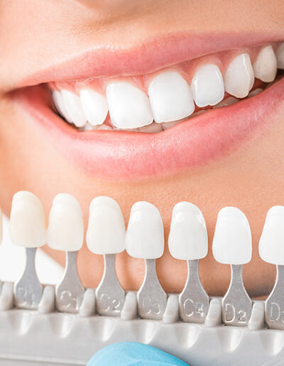 Schedule today to receive five star superior cosmetic dental treatment from award winning mother daughter dentist duo in Gulf Shores and Orange Beach Alabama orangebeachdentists.com Dentist near me Pamela Edwards Gulf Shores coupons Orange beach coupons O cosmetic dentist near me Weekend emergency dentist Gulf shores dentist Emergency dentist near me Dentist Gulf Shores al Dentist orange beach Same day appointments Dr. Edwards dentist Emergency Dentist Diet with a smile Dental history History of dentistry Dentist email address list of Alabama Best dentist in Orange Beach Dentistry history Gulf shores Emergency restoration service Orange Beach al Orange beach dentist Emergency dental treatment near me Dr. Edwards Coastal Mary coupon Edwards coupons Dental hygiene benefits Benefits of dental hygiene Best dental crown material When was dentistry invented Dentist foley al Dental health and wellness History of dental hygiene Orange beach coupon Emergency dentist Foley al Dentist Care credit doctors Best dentist Blue Island History of dental Gulf shores Alabama Best dentist near me Tooth filling Foley al Duo dentist O dentistry What were the most common dental treatments historically Emergency dentistry Gulf coast dentist Gulf Coast Smile doctors dental office near me cosmetic dentist the history of dentistry gulf cove dentist dr. Edwards emergency dentist foley, al dentist gulf cove best dentist in Fairhope al gulf shores dentistry emergency dentist near me orange beach dentistry Facebook dentist best dentist in cosmetic dentistry in Gulf Breeze checkcare holistic dentist top 5 general dentists in Gulf Shores top 5 general dentists in Orange Beach top 5 general dentists in Foley top 5 general dentists in Baldwin County top 5 general dentists in Fairhope top 5 cosmetic dentists in Gulf Shores top 5 cosmetic dentists in Orange Beach top 5 cosmetic dentists in Foley top 5 cosmetic dentists in Baldwin County top 5 cosmetic dentists in Fairhope evolution of dentistry dental implants Gulf Shores al Dr Mary Long history of dental surgery diet with smile Dentist South Gulf Cove Best dentist near me al care dental Edwards dentistry Dr Pamela Osborne Dentist history Dental implants orange beach al Emergency dental services Orange beach family dentistry Best beaches on the gulf coast of Alabama Emergency dental near me Ancient dentistry Snorkeling in gulf shores Benefits of a healthy smile Emergency dental care near me Emergency dental care Edwards family dental Emergency dentist orange Best dentist in my area Dental emergency Same day dentist appointment What are the most common dental treatments historically Cosmetic dentist near me Dental crown material History of dentists Tooth extractions Gulf Shores al Dentist office near me Gulfshore dental Edwards dental Urgent dental care Duo dental Pamela premm Edwards family dentistry Dentistry was one of the first healthcare professions to focus on Alabama dentist Dentist in Foley Alabama Cosmetic dentistry fused to metal Teeth whitening Foley al Orange cove dentist Dentists near me Gulf shore cosmetic and family dentistry Emergency Dentist North Thornton Top dentist mobile Dental history facts Light dentistry Emergency restoration service Gulf Shores al Beaches at gulf shores Alabama Where is Gulf shores Dentists history Dental new patient forms Edwards dentist Emergency dentist Alabama Dental crown Gulf coast dentistry Dentist Facebook Dentist in Foley al Dentist near me news Roman dental hygiene Dentist Edwards co Dr Edwards dds New patient dental forms What to do in gulf shores Alabama Goods good for teeth Food good for teeth Walk in emergency dentist near me Father of dentistry Origin of dentistry Dr Edwards dental Best dentists in my area Gulf shores attractions Dental health wellness Smile saver dental Dr Edwards office Dental technology history Dr. Edwards dentist Pamela Edward Roman dentistry 5 best dentists near me Emergency dental care auburn al Best material for dental crowns What to do in gulf shores Cosmetic consult Emergency tooth extraction Gulf breeze dentist Emergency tooth extraction near me Perdido key dentist Beaches at gulf shores Dentistry was one of the first healthcare professions to focus on: Oral surgery orange beach al Best emergency dentist near me Best dentist for chipped teeth blue island Best dentist for chipped teeth Dehydrated teeth Father of modern dentistry Diet smile Dentist foley 24 hour emergency dentist near me Dentist foley Alabama Gulf cove dental Fort morgan dentist Hot deals and coupons Who was the first dentist Dentist with good reviews History of dental care Dentist Edwards Dentist fort morgan Best dentistry Gulf shores gulf Edwards Family Dentistry reviews Gulf shores dentistry How to rehydrate teeth Pamela’s near me Cosmetic dentistry porcelain fused to metal Fort Morgan Family Dentistry Dental emergency care Historical dentist Good dentist in my area Crown material Gulf Shores in Alabama Ancient history of dentistry Walk in dentist near me Fort Edward family dentistry Oral surery gulf shores al Ancient dentist Dentist o Dentist in foley Dentists emergency dental services History dentistry Dentists foley al Emergency restoration service perdido beach al Edwards beach Dentist reviews in my area Fluoride dental treatments Chlorhexidine coupon Dr Edwards dentistry Emergency dentists near me Dental care Well being dental Oral surgeons near me Cosmetic dentistry porcelain fused Dentist dr Edwards Edwards feed History of dentist Beachwalk dental Gulf shores doctors Alabama gulf shores Gulf shores Alabama Best dentist in mobile al Dental clinic near me Dental Family Dentistry Smile diet Benefits of taking a vacation Best dentist in Alabama Best Dentist Near Me blog Gulf dentist Dental care emergency Enamel remineralization cost The best dentist in my area Good dentists in my area Who take care credit cards Po dentistry What do you call a female dentist Dental hygiene in the middle ages Dentist in Orange Beach al Dentist open on Saturdays Gulf shores dental Gulf Shores local news Orange Place Family Dentistry Dredwards Best dentist near me news When did dentistry start Dentist on Alabama Ave Dental saver Best dentist doctor near me Quality dental supply Gulf shore Alabama Dental offices near me Foods that are good for teeth Biological dentist near me Perdido family dentistry Gulfshore dentistry Pam Edwards Florida Dentists in foley Alabama Edwards fort morgan Dentist in Orange Cove Health benefits of taking a vacation Snorkeling in Gulf Shores Alabama Snorkeling gulf shores Best beaches gulf shores Weekend Dentist Edward street dental Edwards long beach What is the best dental crown material Which of the following civilizations contributed to advancement of dentistry Past dental history Ancient roman dentistry Ancient dental work Dental disease dates back to the Edwards dental lab During the Renaissance period, much surgery and dentistry was performed by Teeth dehydration When did dentistry begin Smile foods Dentist facebook page History of tooth extraction Dr po dentist Dentist sunset attitude Scuba diving Gulf Shores Alabama Gulf family dental Advanced dental wellness Dentistry on 116 Best general dentist Dental wellbeing History of oral hygiene Dentist reviews Premium family dental Foley family dentistry Top Dentist Dentist coupon Periodontist near me Holistic dentist near me Dentist my location Dental Office Tooth healthy foods Emergency dental Dental Clinic Diet a smile Cosmetic dentistry Dental emergency near me How to hydrate your teeth How to hydrate teeth When was dentist invented Gulf shore cosmetic and family dentistry Walk Shores Dental care Dentistry timeline Dentist in Edwards Dr deals Doctors in Gulf Shores al Edwards dental clinic Smilesaver Prosthodontist near me Pediatric dentist near me Dentist open on Saturday Teeth whitening 24 hour dentist near me Long dentistry Gulf shores weather Dentist emergency near me Urgent dental care near me Affordable dentist near me Emergency dental open on Sunday Teeth bonding near me Dentists near me that accept delta dental Dentist open Saturday Best rated dentists near me Teeth whitening near me Same day tooth extractions 24 hour dental emergency near me 24-hour emergency dentist near me Best dental clinics for preventive care Dentist online appointment Dentist open on Sundays Dentist open Saturday open now Emergency dental care near me 24 hours Laser teeth whitening near me Make a dentist appointment online Cosmetic bonding Same day dental history of american football dental jokes dentist gulf shores american football history emergency dentist gulf shores dentist near me dr pamela edwards gulf shores dentist history of football in america history of football origin of american football the history of american football pamela edwards emergency dentist near me dentist gulf shores al evolution of american football funny dental jokes american football origin where did american football originate dentist jokes origins of american football dr edwards dentist dentist orange beach dentist in gulf shores the evolution of american football dentist in gulf shores al dental puns football history facts funny dentist jokes american football origins when was american football invented where was american football invented history of dentistry edwards family dentistry history of football american how did american football start history of nfl what is the history of american football dental joke origins of football american dentist history of the nfl dentist in gulf shores alabama dentists near me emergency dental near me why was american football invented football american history 24 hour emergency dentist near me dr. pamela o. edwards dentistry football origin football history the history of football in america dentist puns the origin of american football dental jokes 2025 where did football originate origin of football american emergency dentist foley al american football history facts how did american football originate edwards dentistry dr. edwards dentist dental emergency near me dental knock knock jokes emergency dentist how was american football invented orange beach dentist origins of football when did american football start who invented football american when did football become popular teeth jokes gulf shores dentistry history american football facts about american football history dental jokes for kids history of the american football dentists gulf shores dentist open on saturday who created american football diet with a smile dentist joke where did american football start who invented american football dentist foley al facts about football history what is the origin of american football the history of football the history of dentistry best dentist near me why was american football created family dentist near me emergency dental care near me dental humor how did football start in america history of holidays smile jokes dentist orange beach al dentist foley alabama american football evolution dentist office near me the history of the nfl evolution of the nfl where did american football originally come from modern american football cosmetic dentist near me funny dental puns the history of nfl 24 hour dentist near me dental jokes for adults dental offices near me bad teeth jokes jokes about bad teeth free dental clinic near me teeth whitening near me dentist gulf shores alabama urgent dental care near me march madness traditions halloween history when was football invented in america when did football start in america dr edwards history of halloween nfl history origin of football where does american football originate from invention of american football when did american football originate dr. edwards orange beach dentistry football facts and history where was american football originated gulf shores alabama what is the history of football evolution of dentistry dental office near me emergency dental care history about american football when did football become popular in america how american football started emergency dentist foley, al invention of football nfl facts and history tooth puns evolution of football jokes about dentists articles about football history family dentistry gulf shores al football history american dental emergency denture jokes origins of football in america history of american football facts history of us football american football timeline dr edwards dental american football information dentist jokes puns early history of american football origins american football dental dad jokes history of the holiday american football origins and history joke about teeth dental hygiene jokes jokes about smiles endodontist near me dental jokes funny dental clinic near me funny dentist joke teeth whitening two changes between early football and modern day football alabama beach emergency dentist orange beach al funny jokes about dentists history of football article funniest dentist jokes the joy of the christmas season 24 hour emergency dentist emergency dentist orange beach dentist office cosmetic dentistry near me prosthodontist near me emergency dental clinic oral surgery jokes 24-hour emergency dentist near me no insurance the history of football american dental jokes 2024 delta dental dentists near me why is american football popular dentist open sunday 24 hour dental emergency near me weekend dentist near me top 10 best dentist near me dentist open on the weekend near me dental office accepting medicaid american football story holiday history dental history football halloween origin when was american football created halloween origins weekend emergency dentist where was american football created what year was american football invented football in america tooth jokes who was the inventor of american football cosmetic dentist edwards dentist how did football become popular gulf coast dentistry dentist dad jokes emergency dental services edwards dental where did football originate in america dentist edwards orange beach family dentistry origin of halloween dentist jokes for kids american football originated in which country american football sport american football in america what are the origins of american football american football creation where did american football originate from when was american football first played jokes about teeth history of professional football when did american football get popular what were the most common dental treatments historically dental office founder of american football when and where did american football originate dental clinic who started football in america when did football get popular dentist perdido key the origins of american football when was american football started did football originate in america us football history what country did american football originated in how american football was invented nfl origin brief history of american football history of football facts where was american football founded nfl football history dentist pun facts about the history of football halloween day history what is the origin of football dentist in foley al pam edwards florida information about american football football invention american football facts and history american football american teeth joke who is the father of american football american football beginning dentist jokes for adults dentist humor christmas season of light dental joke of the day how was american football created birth of american football where does american football come from nfl origins history of the holidays short dentist jokes for adults dentist in foley alabama when did football become popular in the united states history of dental care teeth puns american football league history football history in america history of dentist football facts history how old is halloween evolution of nfl alabama shores how football became popular funny dental joke the origins of football dentist in orange beach al dentists jokes gulf shores dental dirty dental jokes jokes for dentists dental jokes of the day football beginning the history of holidays season of joy dentist in foley dental.jokes when is the best time to visit orange beach alabama american football info football origination how has american football changed over the years knock knock jokes about teeth american football invented year periodontist near me best dental jokes pam edwards emergency dentists near me walk-in emergency dentist near me dentist jokes funny pamela dentist original american football modern nfl the history of the football emergency dentist near me open now history of america football ancient dental practices dental crown the origins of halloween the beginning of american football the history of a football long dentistry urgent dentist near me molar bear joke dentist emergency near me the original football dental funny jokes when did football come to america dental office jokes jokes dentist puns dental jokes funny jokes about teeth history of halloween day dentist near me open now spring dental puns ancient history of dentistry nfl modern era christmas is the season of joy holistic dentist near me who discovered american football nfl creation tooth ache jokes pediatric dentist near me emergency dentists cheap dentist in foley, al what was american football originally called history of orange beach alabama female dentist near me how long has american football been a sport best dentists near me alabama beaches biological dentist near me nba global reach modern era nfl why is football so popular in america funny dentist jokes for adults dr. edwards dds dentist newr me gulf shores int. airport opens dentist near me that accept medicaid holloween history history if football tooth jokes for kids dentist my location history of american football rules very first football game futbol moderno dentist that accept alabama medicaid near me dentist around me christmas is a festival of joy after hours dental care near me gulf shores weather dentist open saturday things to do in gulf shores alabama history of foot ball affordable dentist near me fifa dentist appointment near me emergency dentist open on saturday emergency dental clinic near me founding of the nfl emergency dentist near me open today after hours dentist emergancy dentist near me sedation dentistry near me dentist open on sunday cheap dentist near me emergency dentist open on sunday near me pediatric dentist near me that accepts medicaid funny dental jokes for kids diÅŸ aÄŸrÄ±sÄ± komik sÃ¶zler dentist that accept medicaid urgent care dentist near me article about football history cheap dentist with payment plans near me conclusion for halloween emergency dental near me open now free government dental clinic near me veneers near me 24/7 dental near me debtist near me teeth bonding near me emergency dentist near me that take medicaid dentist open saturday walk-in near me dentist dentist open on the weekend origins of spring break gulf coast dental foley photos description of mardi gras father of dentistry in world dentist that accepts medicaid for adults emergency dental open on sunday halloween conclusion philips zoom whitening near me book dental appointment online dentist near me open weekends cuando se creo el football americano dentists near me that accept delta dental how many professional football teams are there emergency denist after hours emergency dentist humor dental puns professional teeth whitening best rated dentists near me dentest near me free teeth cleaning near me dental.offices near me pediatric dentist medicaid accepted near me same day dentist near me magia Å›wiÄ…t boÅ¼ego narodzenia walk in dentist emergency who takes delta dental near me facts about nfl history same day tooth extractions cash only dentist near me football invented by which country dr edward long 24 hour emergency dental near me 24 hours dental emergency 24 hr dental emergency 24-hour emergency dentist near me affordable dental extractions near me any dentist open on saturday beaches alabama best child dentist near me best dental clinics for preventive care best teeth whitening near me children dentist near me medicaid coastal family dentistry gulf shores al dental payment plans near me dentist accept medicaid near me dentist cash pay near me dentist in fairhope alabama dentist near me accepting new patients open now dentist no insurance near me dentist online appointment dentist open on sundays dentist open saturday open now dentist who take medicaid near me dentista cerca de mi en espaÃ±ol dr.parent emergency dental care near me 24 hours emergency dentist near my location emergency dentists near me open today emergency root canal laser teeth whitening near me make a dentist appointment online md dentist myofunctional dentist near me pamela doctor same day tooth extraction near me open now same day tooth implant top rated emergency dentist near me open now who does dentures near me wisdom tooth extraction no insurance alabama beach rv parks biomimetic dentistry near me cosmetic bonding dentist near me that use nitrous oxide weather in gulf shores in march what country created football christmas message on joy dentist ratings and reviews frank whittle gulf shores alabama vacation rentals joy christmas verse teeth veneers the nfl is entering a troubling new era emergency dentist weekend near me nfl uk old school dentist near me dentist near me with late hours how was the nba formed the joy of christmas sermon national geographic football zahnarzt mittelalter urgent dentist care near me pediatric dentistry near me same day dental ancient egyptian dentist halloween day what is the christmas holiday season seasonal affective disorder american football invented christmas season dental health and wellness gulf shores best dentist in orange benefits of dental visits gulf shores coupons o cosmetic dentist near me gulf coast dentist how long has american football been around dentistry history best dentist long beach 2023 holiday existence where was football invented in america emergency dentist dunlap orange beach coupons where is american football from best dentists in baldwin place best dentist baldwin place teeth whitening foley al dentist email address list of alabama american football emergency dentist fort walton beach tooth filling foley al origins of halloween emergency dentistry when did professional football start coastal mary coupon is football an american sport edwards coupons when was football invented emergency dentist fort walton beach fl where did american football come from when american football was invented emergency restoration service orange beach al gulf cove dentist seasonal affective dentist gulf cove football in us how has american football changed over time what is orange beach known for historical holidays history holiday father of american football emergency dental treatment near me when was football invented american chronology holiday dental health & wellness perdido orthodontist activities at orange beach alabama dental holiday chronology halloween holiday inventor of american football dentist funny food good for teeth facts about american football dentist south gulf cove history of american football timeline when did football start where did american football originate? history football football origins what state was football invented cosmetic dentistry football american when was the first football game played when was dentistry invented affective disorder emergency dental care fort walton beach fl dr edwards dds best dentist in fairhope al dentist history seasonal affective disorder symptoms emergency dental history of dental where holiday history who holiday history restorative dentistry foley best dentists in foley when holiday history cosmetic dentist foley when was american football founded dr valexia edwards cosmetic dentistry foley emergency dentistry near me when was nfl football invented history of dental hygiene why holiday history sedation dentist foley how holiday history american football facts edwards family dental where did halloween originate holiday celebrations are a time of joy was football invented in america best dental crown material when did american football begin dental friendly dr pamela wade best dentist near me al care dental when did american football became popular what history holiday us american football diet with smile when was america football invented "what are some modern halloween traditions that have evolved from ancient practices" care credit doctors dr pamela osborne facebook dentist who history holiday when did american football become a sport who started american football how history holiday when was the first american football game played american football america american football us childconsent checkcare dental new patient forms what is american football when history holiday when and where was american football invented the history of halloween gulf coast smile doctors emergency dental care fort walton beach when did football become a sport dentistry american football culture good things for teeth american football blog dental well being dental hygiene benefits american football invention when did american football start in america emergency tooth extraction pam edwards facebook creation of american football ancient dentistry sad disease foods good for teeth best dentist near me open now american football originated from which two sports? dr mary long best time to visit orange beach alabama orange beach alabama vacation ideas attractions in gulf shores al what country invented american football where did halloween come from orange beach coupon benefits of dental hygiene what state invented football halloween origin story american football is related to what two english sports? dental history facts where did football originate from where did nfl originate new patient dental forms cold weather trouting snorkeling in gulf shores best dentists in fairhope american football creation date tooth extractions orange beach teeth whitening foley best dentist in american football inventor dental crown material where does halloween come from dentist facebook best cosmetic dentistry in orange american football was developed from which of the following sports? which history holiday halloween history origin when did dentistry start football root dentist near facebook halloween in the old days tooth extractions gulf shores who invented football in america how holiday existence how long has football been around when was american football dental implants gulf shores al best preventive dental care orange dental implants gulf shores when was american football first invented best dentist duo dentist when holiday existence doctor edwards dentist why holiday evolution wisdom teeth removal orange beach gulfshore dental how civilization holiday is football american american football root dentist open near me early american football history of dentists top 5 general dentists in mobile al best time to visit orange beach history halloween where did football start in america where did american football begin soulard mardi gras history what is mardi gras a celebration of wisdom teeth removal orange beach al christmas and holiday season pediatric dentist history of dental surgery health and wellness dental how did football start origin american football what is the history of halloween where was american football first played tooth extractions orange beach al kids dentist wisdom teeth removal gulf shores attractions in orange beach al when did american football become popular "what two sports did people in england play that helped create american football?" gulf breeze family dentistry roman dentistry football and america o dentistry where american football originated emergency dentist in celebration pet dentist gulf shores when was the first game of american football played football biography in network vs out of network "at the time (1920), how popular was professional football compared to college football?" when did football start in the united states when was professional football invented when was the american football invented origin football tooth extraction foley al what came first college football or nfl who created football in america best dentist gulf shores al best food for teeth dental implants orange beach al emergency dentist in mobile al the origin of football first halloween ever dentistry was one of the first healthcare professions to focus on same day dentist appointment emergency restoration service gulf shores al halloween holiday history great dentist near me emergency dentist in birmingham al dental care gulf shores al when civilization holiday what year was football invented dental implants orange beach who holiday chronology where did football come from america and football pamela premm wisdom teeth removal gulf shores al nfl history facts what is the origin of halloween best dentist blue island first american football emergency dentist in opelika al dentist questions best dentists in long beach history and halloween why civilization holiday family dentist foley al when was football created dentist edwards co dental consultation gulf shores al cosmetic dentistry gulf shores al offshore dentistry gulf shores al general dentistry gulf shores al first american football game emergency dental care auburn al winter freshwater fish species alabama dentistry services gulf shores al how did football originate oral surgeon gulf shores mastering proper brushing techniques what is football in america cosmetic dentist luck beaches at gulf shores alabama free cosmetic dentistry consultation gulf shores al america football emergency dentistry gulf shores al who chronology holiday importance of regular dental cleanings things to do in orange beach and gulf shores al history of football in usa how to hydrate teeth how timeline holiday which chronology holiday past dental history root american football tooth extractions gulf shores al which country invented american football emergency dental fort walton beach fl why timeline holiday what two sports did football come from? how holiday chronology two changes between early football and modern-day football when did football become a professional sport how long has professional football been around elizabethan dentistry father of dentistry how old is football american origin of dentistry what is football american how old is american football who founded american football credit cards for dentists light dentistry how did american football evolve from rugby and soccer tooth joke oral surgeon orange beach halloween traditions football started in what year best dentists thornton emergency dentistry how chronology holiday what state was american football invented emergency restoration service perdido beach al why chronology holiday walk in emergency dentist near me where was football invented what does out of network mean history of football origin how did halloween traditions evolve over time dentists history top 5 cosmetic dentists in mobile al best dentist in my area when did the american football begin when chronology holiday family dentist foley american football blogs who civilization holiday rated best dentist halloween origin country root canal gulf shores al history holidays duo dental why holiday chronology what state did football originate in how did american football spread what chronology holiday who started nfl football alabama dentist smile saver how did halloween originate female orthodontist near me what did american football originate from when was american football established urgent dental care background of halloween history behind halloween emergency dentist north thornton history facts about football largest mardi gras celebrations why was american football made american football invention date how was football invented in america american football created football in the us when did football start in usa who invented football funny dentist all about halloween history dental health wellness halloween halloween started in what year when was football american invented family dentists foley al dr pamela shore how to make american football sad disorder dentistry was one of the first healthcare professions to focus on: how did american football spread around the world bryan foley dmd orthodontist did american football come from rugby history dentistry gulf breeze dentistry modern day football gulf breeze dentists emergency dentist near fairhope al hot cycle gulf shores cold weather speckled trout dental cleaning how to hydrate your teeth funny dental american association football emergency dentist auburn al emergency dentist orange why are american footballs so expensive crown material o'neill family dentistry gulf breeze dental where holiday chronology when holiday chronology where was football invented american dr edwards office 500-1025 dr marsha edwards what was the first american football team when football began why was halloween created dentistry jokes where did the nfl originate where is football from oral surgery orange beach al where did football start best dentist in the area trusted dentist questions to ask your dentist gulf shores urgent care walk in clinic top dentist mobile beginning of american football what country was american football invented in who created nfl football what year did american football start cosmetic dentist edwards football started dental technology history was american football invented in america what holiday history when did football originate why is american football so popular dr best dentist roman dental hygiene dentist near me news what civilization holiday "what are some modern halloween practices that originated from ancient rituals" when was football popular football roots history about football o neill family dentistry history of the football where was american football invented? why was football invented benefits of a healthy smile smile saver dental orange cove dentist gulf breeze dentist orange dentist start of american football dr.edwards halloween country of origin xmas season nfl football background gulfshores emergency dentist thornton when did professional football begin history of nfl football oral surgery gulf shores al what are the most common dental treatments historically why holiday past why was football invented in america how was football invented tooth extractions foley al origins of nfl why did american football start diet smile when was professional football started where was american football made what state was football invented in holistic dentist mobile al scuba diving gulf shores out of network insurance crowns for cosmetic dentistry where chronology holiday american football country of origin how did american football develop when did football start in the us funny teeth jokes when was nfl invented woman dentist near me how american football is played how holiday past the first american football origins of the nfl american football was invented birthplace of american football cosmetic dentist in celebration benefits of regular dental visits who was the first dentist dental riddles dentists with good reviews affective disorders which celebration chronology when did pro football start in america how did football get popular when was us football invented american football started best local dentist